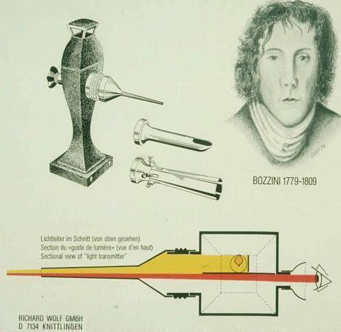 从抗击新冠状病毒看内窥镜发明人历史