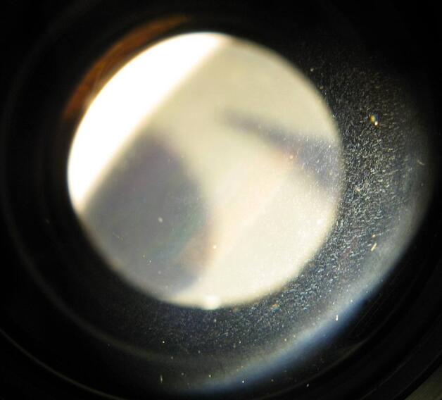 内窥镜镜头起雾和污染有哪些应急处理方法 内窥镜镜头起雾和污染有哪些应急处理方法